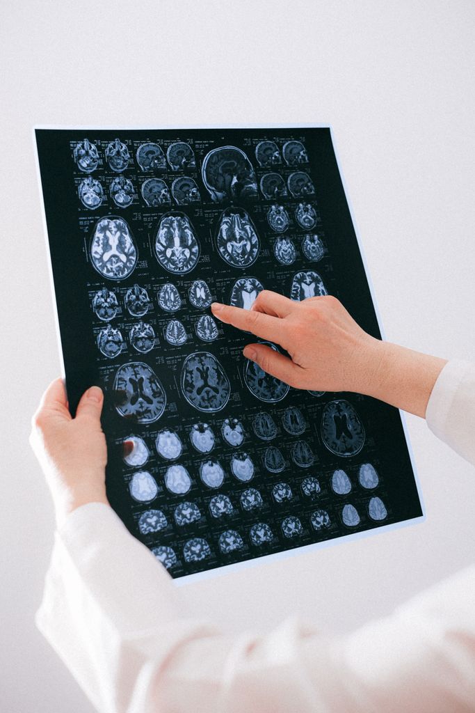 A medical professional examines a brain MRI scan, focusing on neurological health.